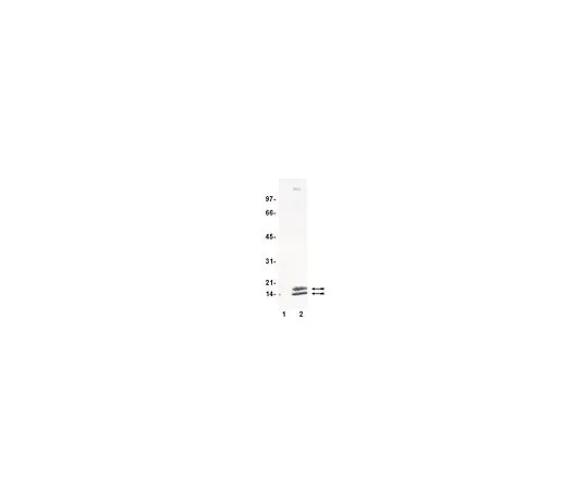 62-8382-37　抗乙酰赖氨酸;100μL　06-933