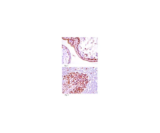 62-8375-37　抗IGF-1R,克隆24-57;100μg　05-1571