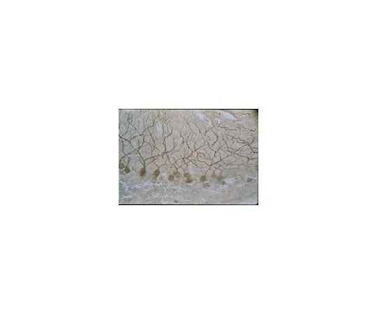 62-8445-30　抗NMDAR2B;10μg　AB1557P