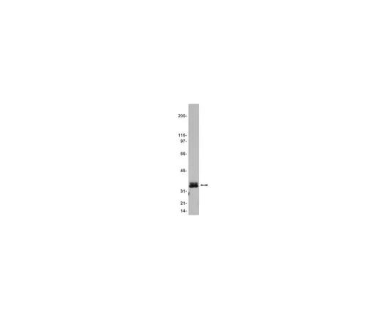 62-8371-76　抗LAT,克隆2E9;100μg　05-561