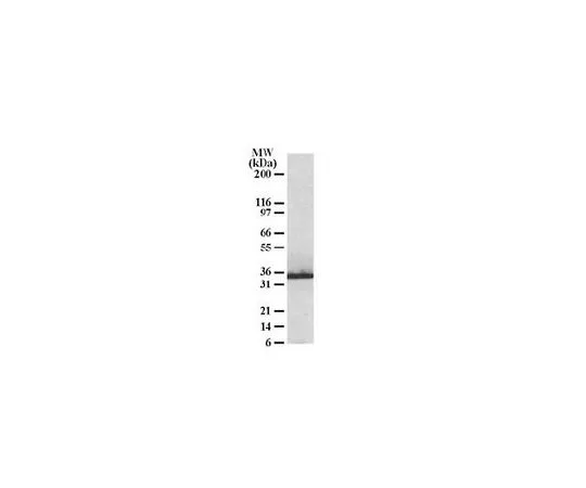 62-8453-96　抗CHIP/STUB1;100μg　AB10000