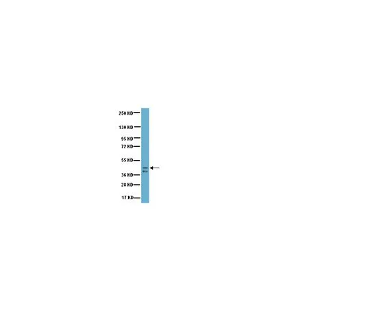 62-8449-52　抗生长相关蛋白-43 (GAP-43);100μL　AB5220