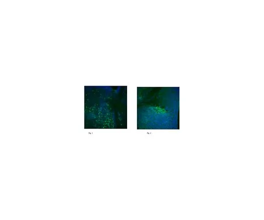 62-8466-38　抗前列腺素同源框蛋白1/PROX1　ABN278