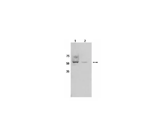 62-8454-07　抗CYP450,克隆2E1;100μg　AB10080