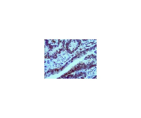 62-8469-35　抗MLK1;100μg　ABS94