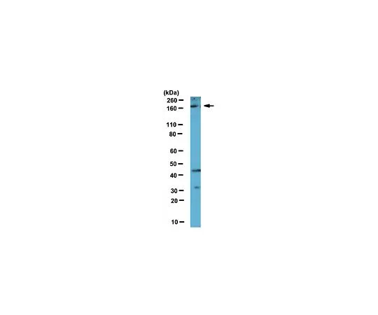 62-8460-67　反Set1A;100μL　ABE212