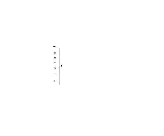 62-8454-40　抗PACSIN1, N末端;100μg　AB10439