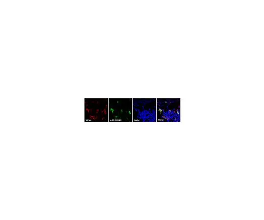 62-8468-19　抗C9ORF72/C9RANT (Poly-GR)　ABN1361