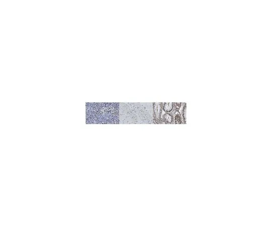 62-8468-89　抗GLI2　ABN2241