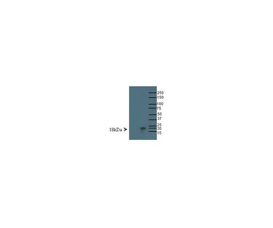 62-8455-69　抗LMOM;100μg　AB15640