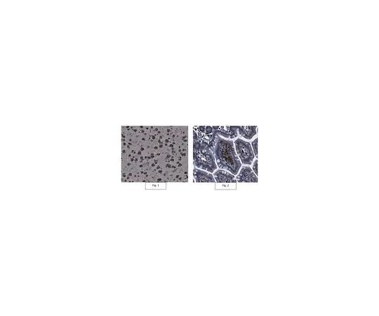 62-8468-46　抗p47-phocopy抗体　ABN1480