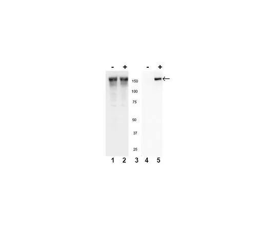62-8386-72　抗磷EGFR (Tyr845);100μL　07-820