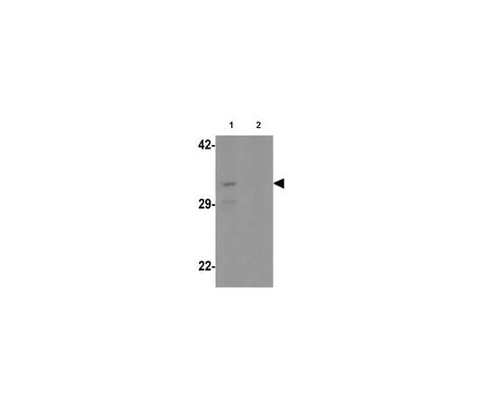 62-8457-66　反CLEC2A　ABC328