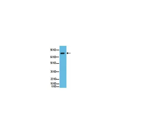 62-8456-23　抗ADAM 10, C末端;100μg　AB19026