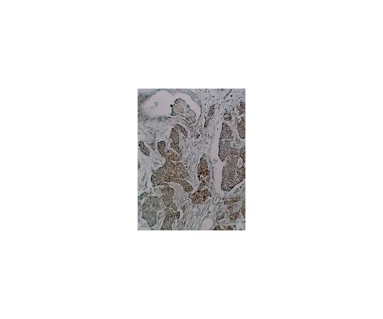 62-8370-74　抗磷酪氨酸，克隆4G10R;100μg　05-321