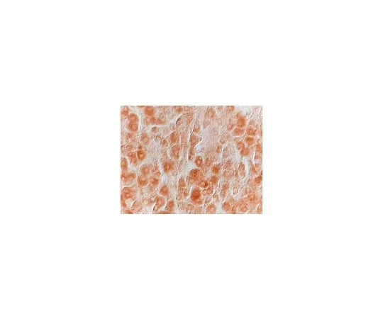 62-8445-08　抗神经生长因子β，疼痛;20μg　AB1526P