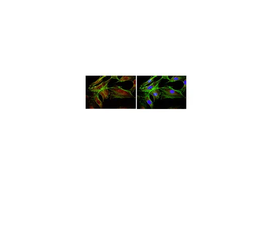 62-8374-12　抗FOXO1,克隆2H8.2;200μg　05-1075