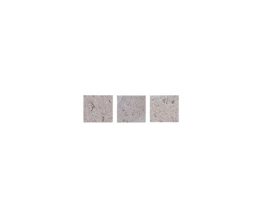 62-8467-14　反菲夫2　ABN428