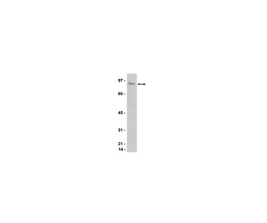 62-8385-96　反ATRIP;200μL　07-625