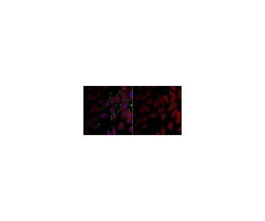 62-8467-89　抗LDHA　ABN896
