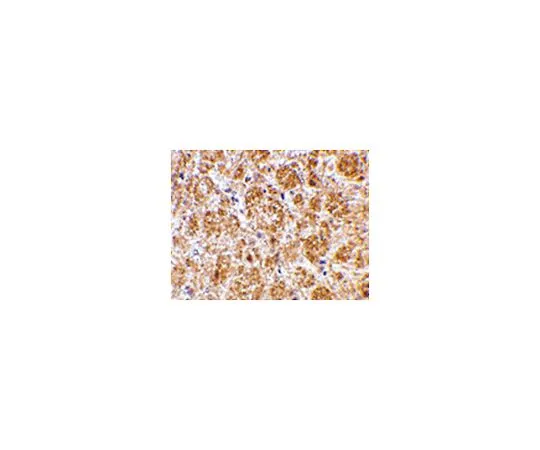 62-8467-63　反DARAC　ABN495