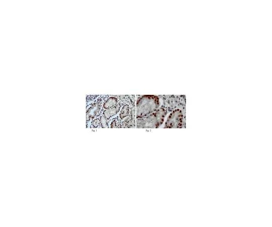 62-8465-66　抗DSCR3;100μg　ABN87