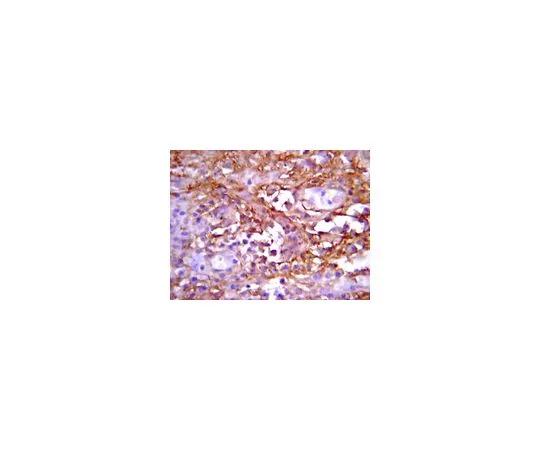 62-8387-28　反缺口1,N端;200μL　07-1232