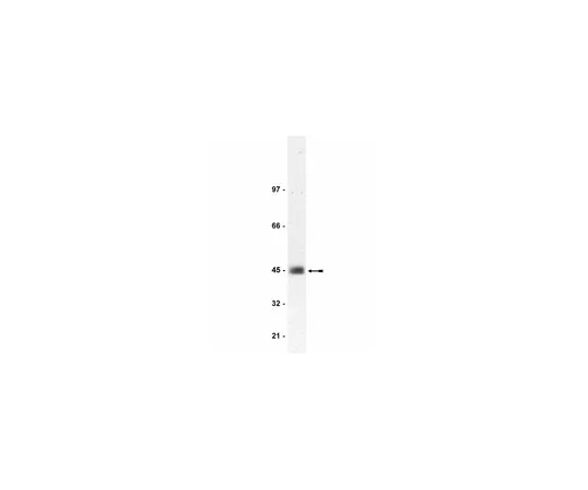 62-8372-19　抗CAR,克隆RmcB;200μg　05-644