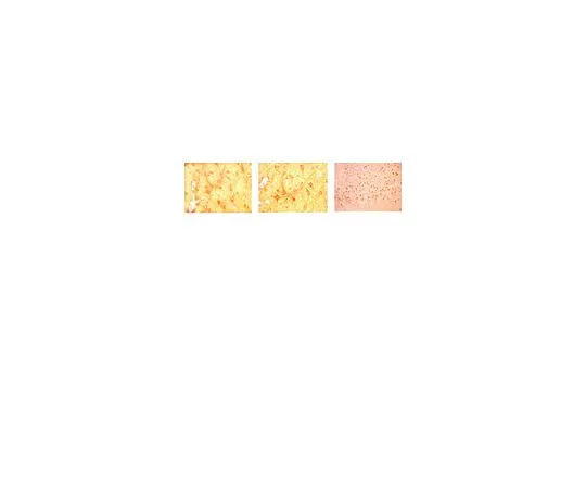 62-8453-93　抗酪氨酸羟化酶;100μg　AB9983
