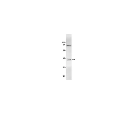 62-8384-23　反AUF1;200μg　07-260