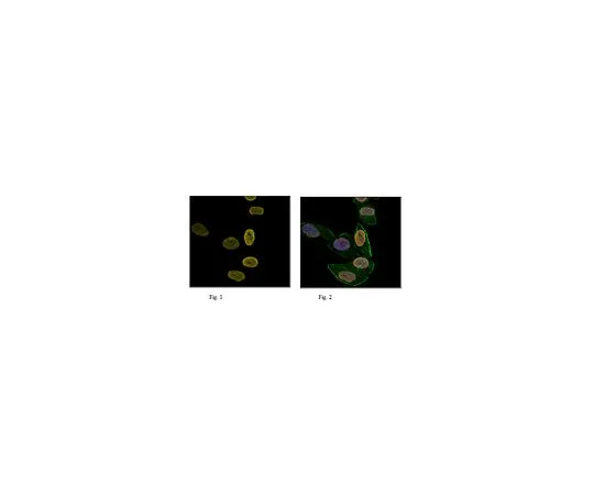 62-8385-19　抗三甲基组蛋白H3 (Lys27) ，Alexa Fluor (R) 647共轭　07-449-AF647