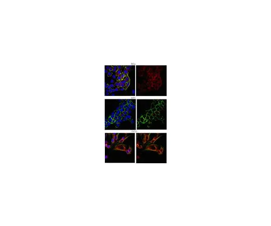 62-8388-41　抗EEA1;100μL　07-1820