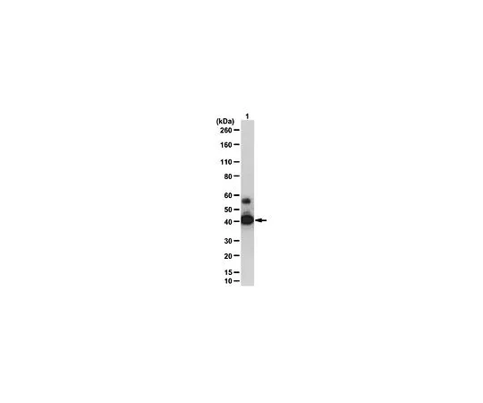 62-8390-07　抗SIRT2;100μg　09-843