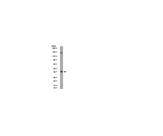 62-8383-14　Anti-SETD8 (hPR-SET7);100μL　06-1304