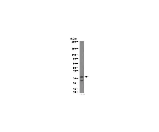 62-8454-46　反DARPP-32;100μg　AB10518