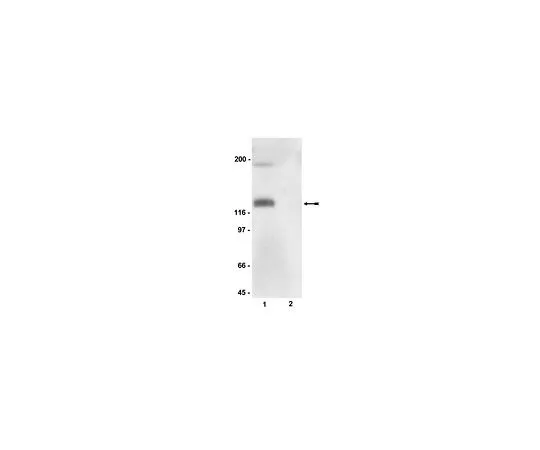 62-8384-61　抗磷-eNOS/NOS III (Ser116);100μL　07-357