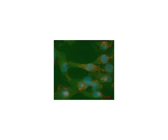 62-8444-80　抗磷ILK (Ser246);100μg　AB1076