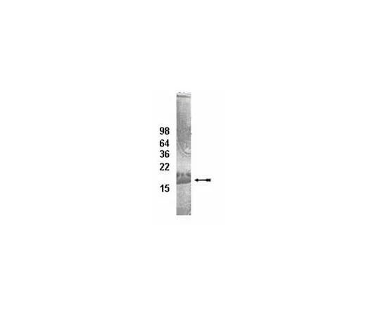 62-8391-69　UbcH8共轭酶;100μg　14-814