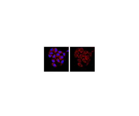 62-8369-11　抗SMN,克隆62E7;100μg　04-1466