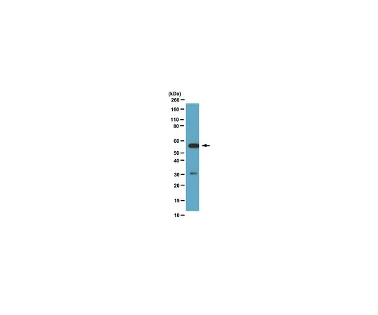 62-8387-84　抗钙调神经磷酸酶平底锅A;100μL　07-1491