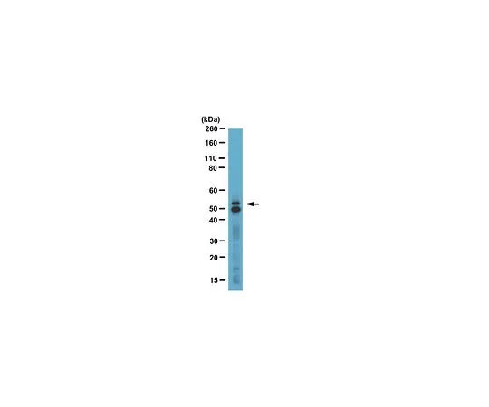 62-8387-60　反GLUT-5,a.a。490-502;50μL　07-1406