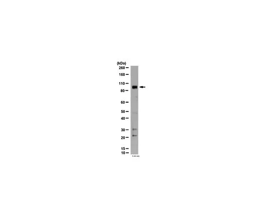 62-8465-87　抗PDE4D3;100μg　ABN117