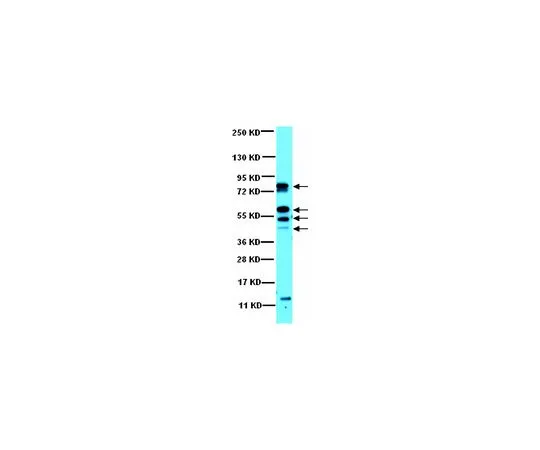 62-8387-88　抗CaM激酶II;100μL　07-1496