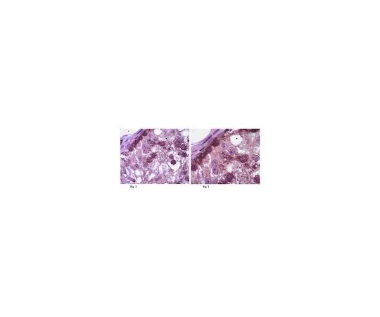 62-8461-30　反DAZ;100μg　ABE374