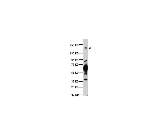 62-8448-10　抗钠，钾，氯化物共转运蛋白1;50μg　AB3560P