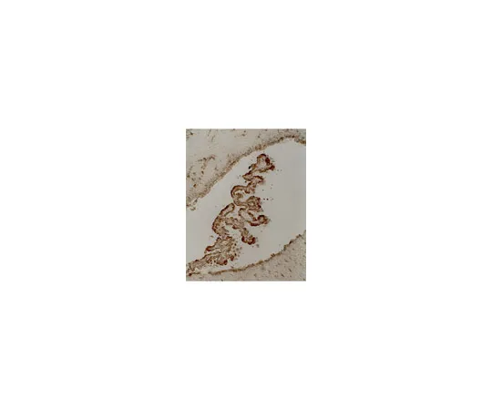 62-8370-81　反托，克隆5E2;200μg　05-348