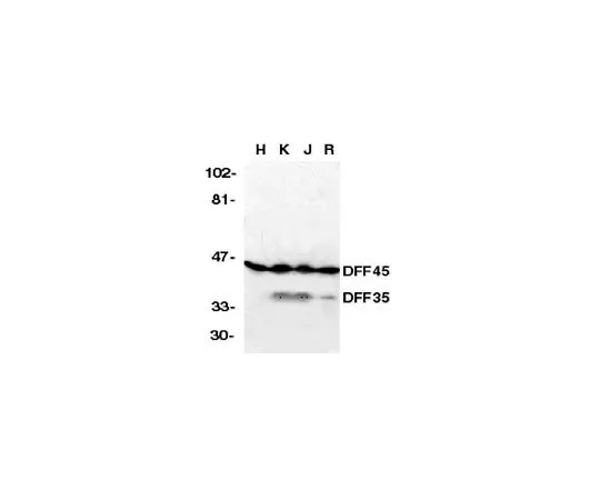 62-8456-12　抗DFF45/35, N末端;100μg　AB16961