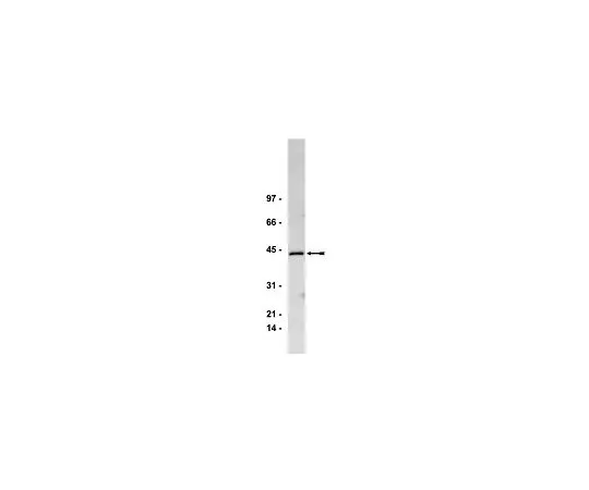 62-8381-93　抗Gq/11α，CT;50μL　06-709
