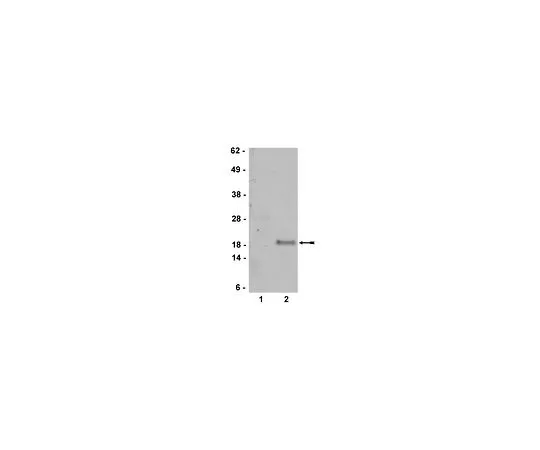 62-8385-62　抗p19ARF;200μL　07-543