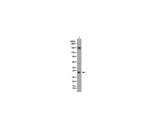62-8460-29　反JMJD8;100μg　ABE91